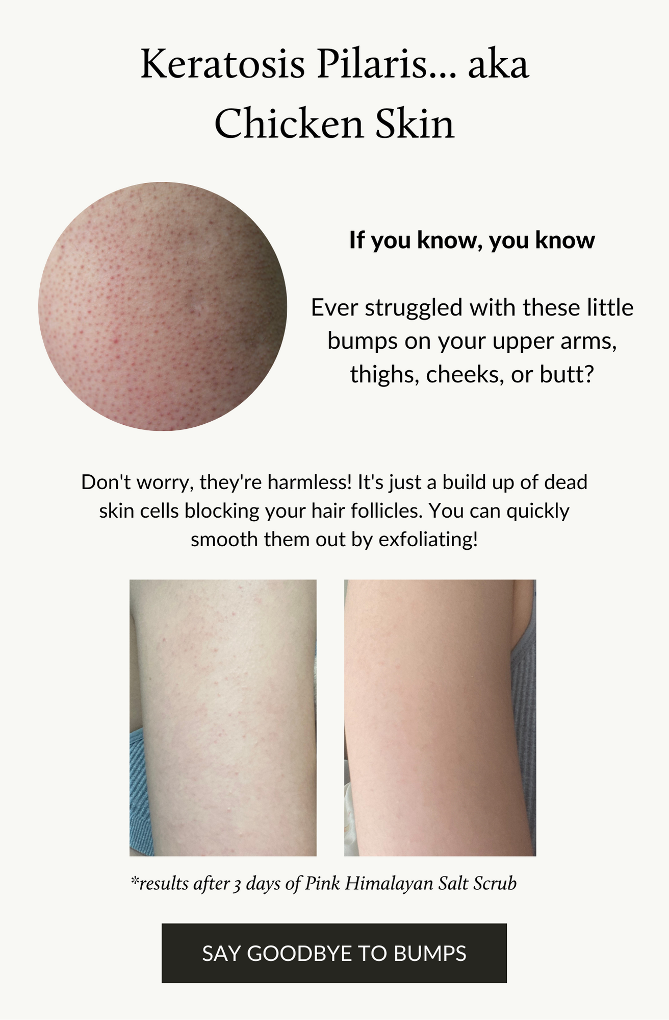 Got Bumps? 😬 Say Goodbye to Chicken Skin Eco Tan