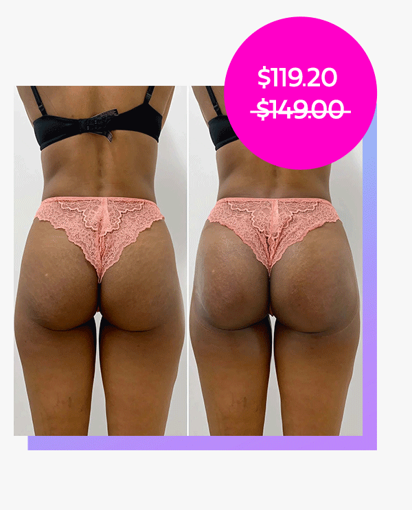 BootyFix: Butt Vacuum Therapy