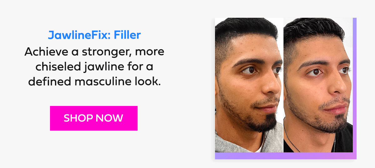 JawlineFix: Filler
