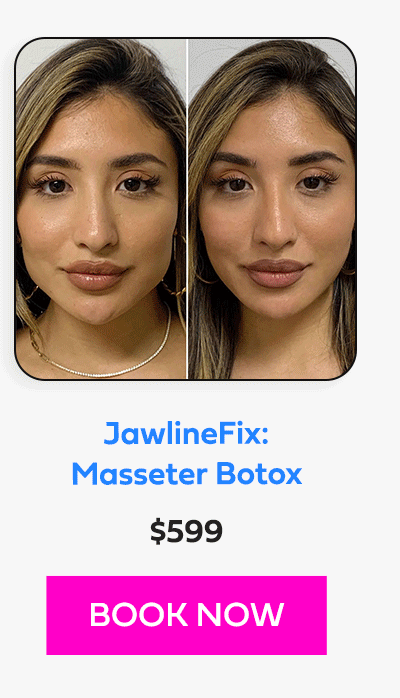 JawlineFix: Masseter Botox