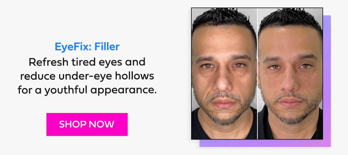 EyeFix: Filler