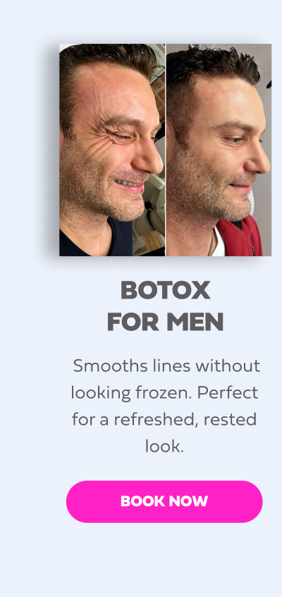 BOTOX FOR MEN