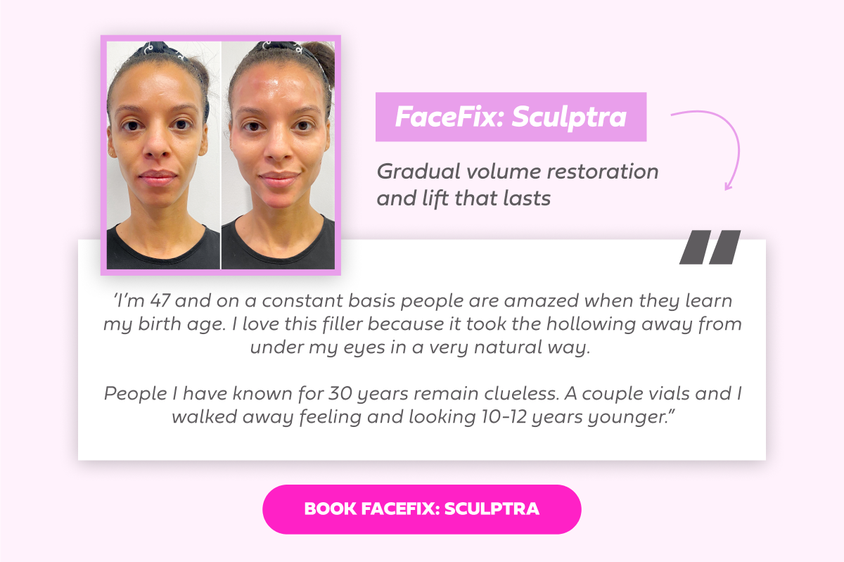 FACEFIX SCULPTRA