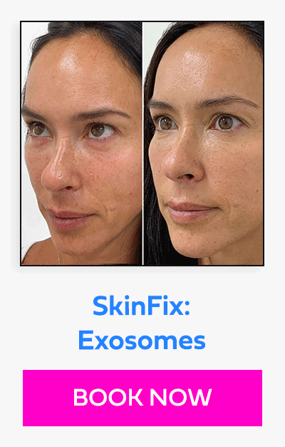 SkinFix: Exosomes