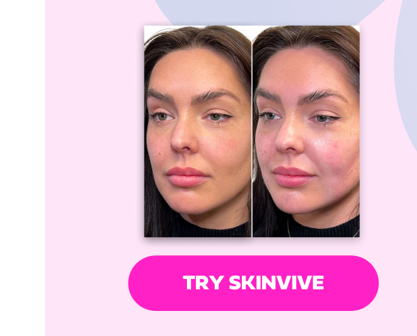 SKINVIVE