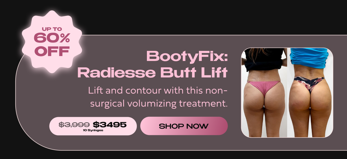 BOOTYFIX RADIESSE BUTT LIFT