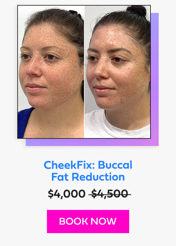 CheekFix: Buccal Fat Reduction