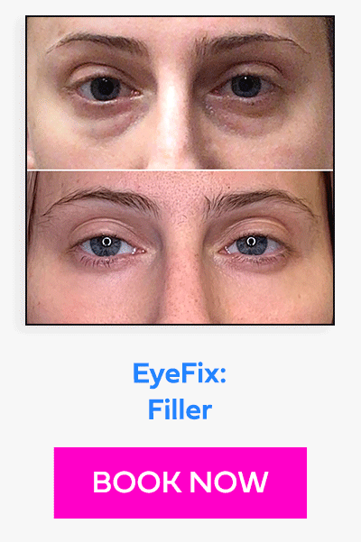 EyeFix: Filler