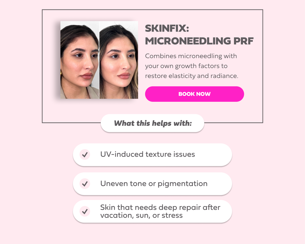 SKINFIX MICRONEEDLING PRF