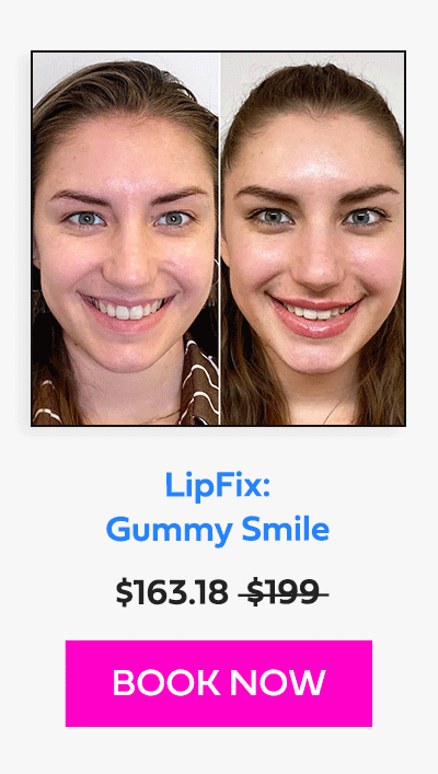 LipFix: Gummy Smile