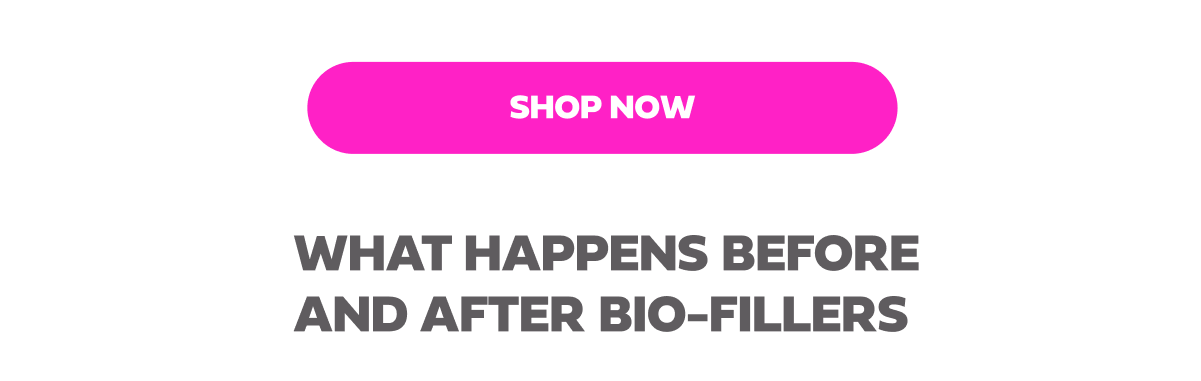 WHAT HAPPENS BEFORE AND AFTER BIO FILLERS