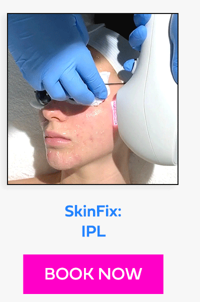SkinFix: IPL