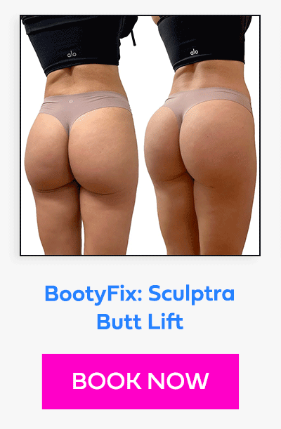 BootyFix: Sculptra Butt Lift