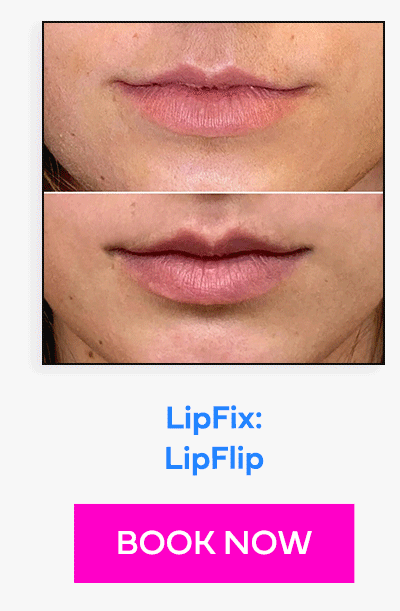 LipFix: LipFlip