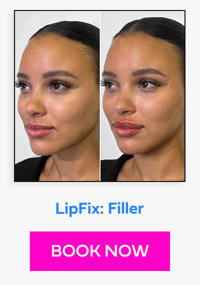 LipFix: Filler