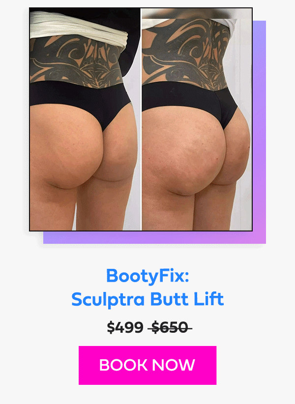 BootyFix: Sculptra Butt Lift