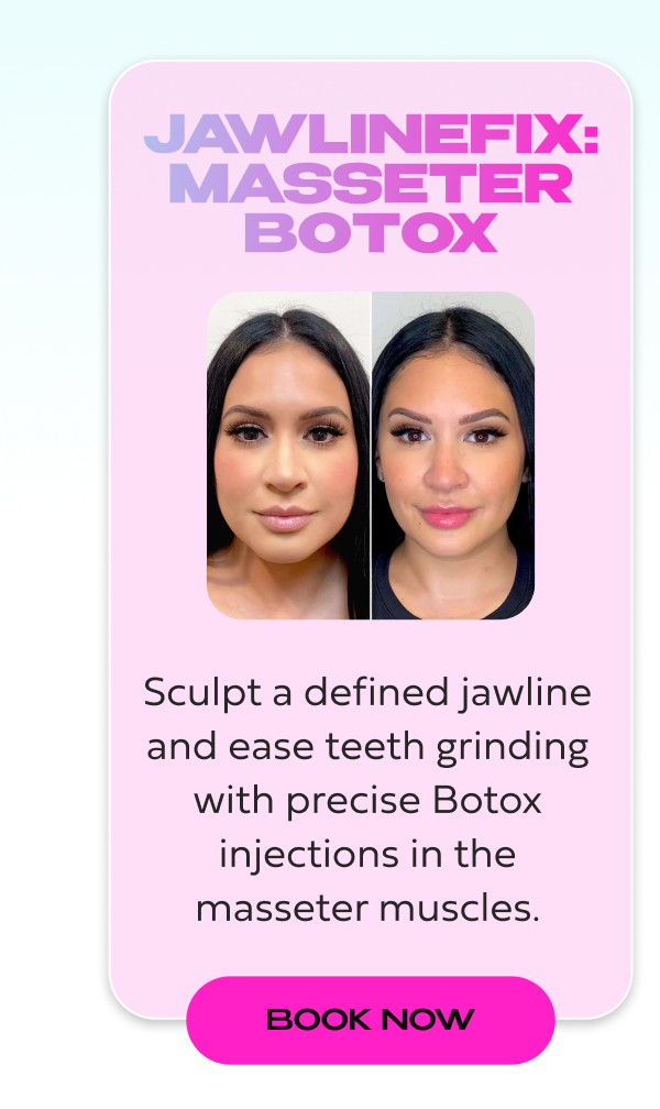 JAWLINEFIX MASSETER BOTOX