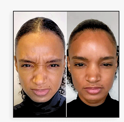 WrinkleFix: Existing (20 Units)