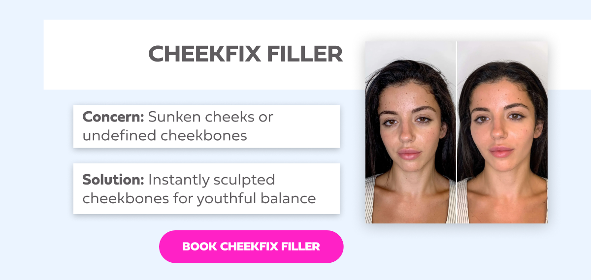 CHEEKFIX FILLER