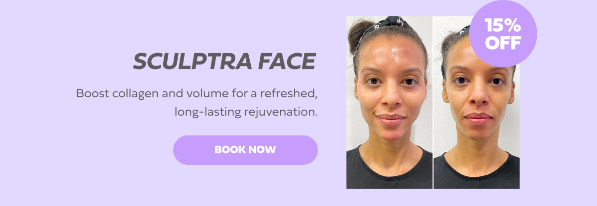 SCULPTRA FACE