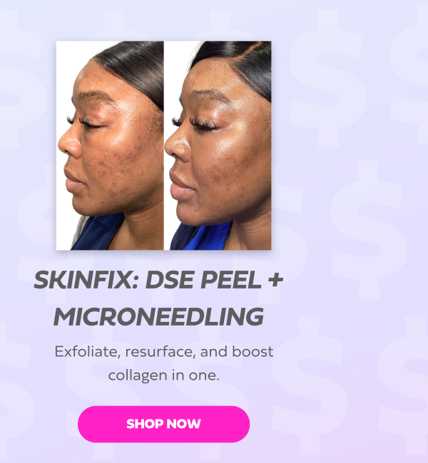 SKINFIX DSE PEEL + MICRONEEDLING