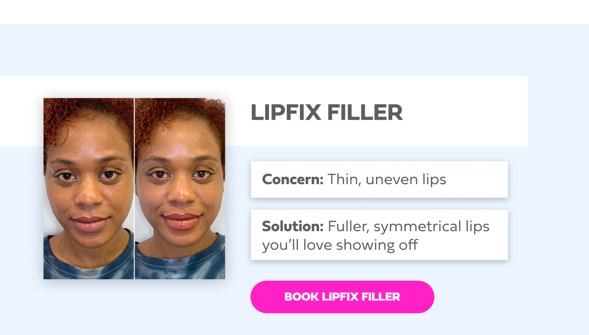 LIPFIX FILLER