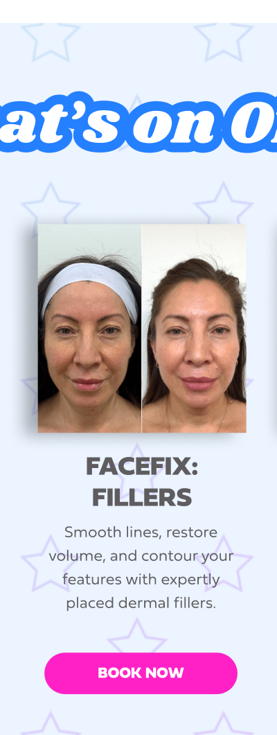 FACEFIX FILLERS