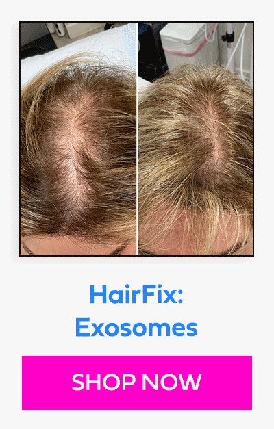 HairFix: Exosomes