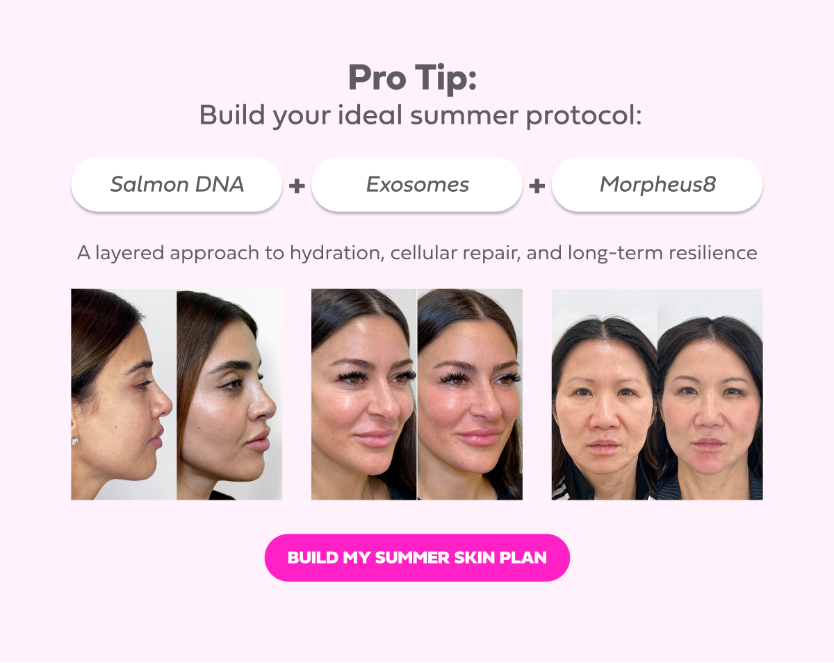 PRO TIP Build your ideal summer protocol:  Salmon DNA + Exosomes + Morpheus8