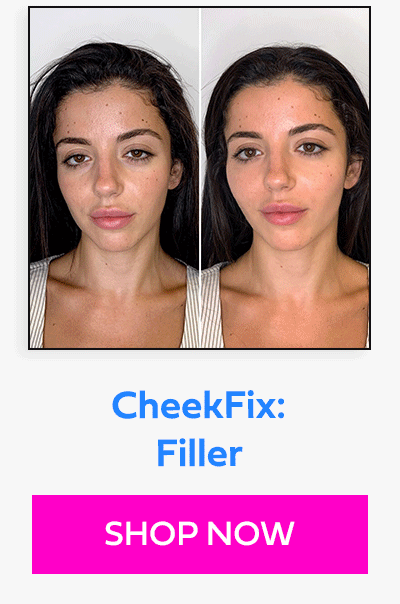 CheekFix: Filler