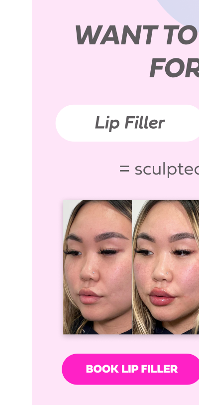 LIP FILLER