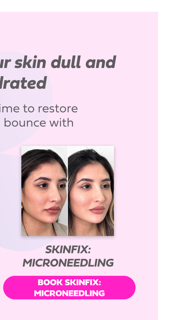 SKINFIX MICRONEEDLING