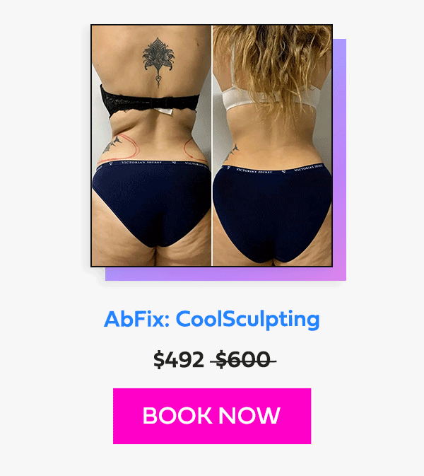 AbFix: CoolSculpting