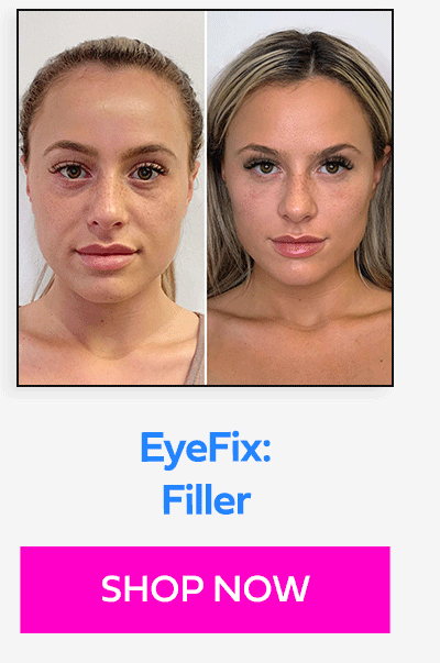 EyeFix: Filler