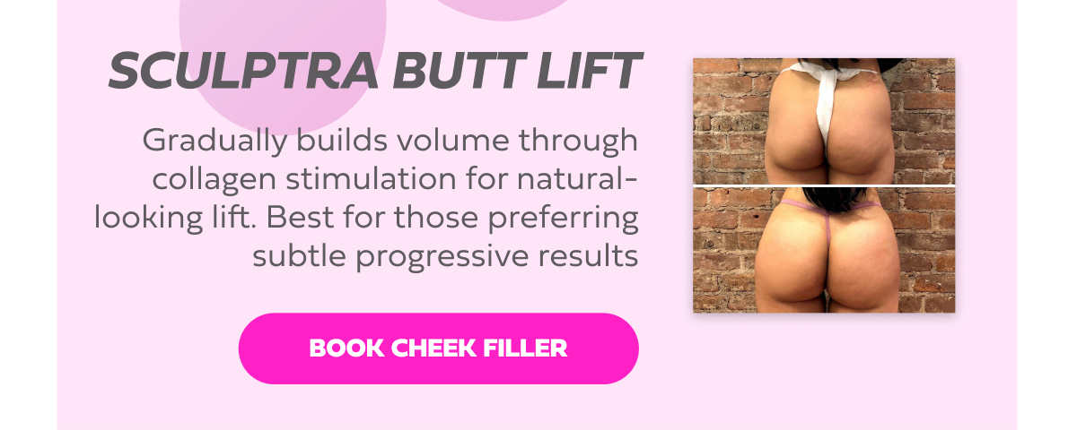 SCULPTRA BUTT LIFT