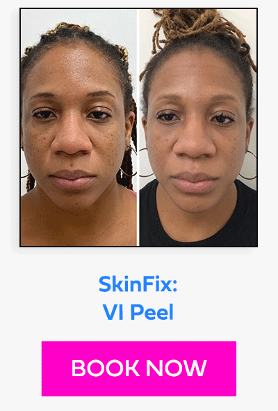 SkinFix: VI Peel