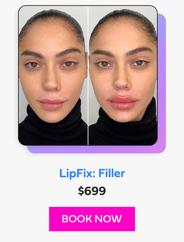 LipFix: Filler