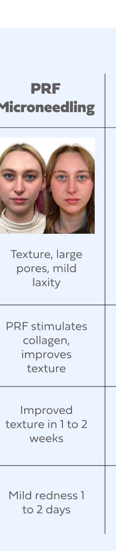 PRF MICRONEEDLING