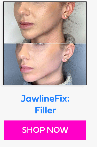 JawlineFix: Filler