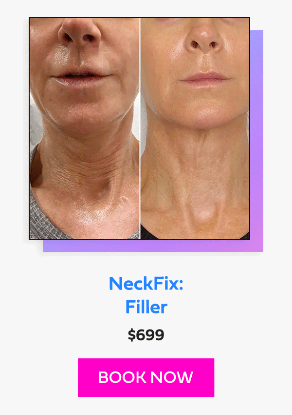 NeckFix: Filler
