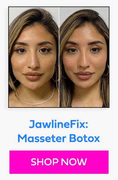 JawlineFix: Masseter Botox