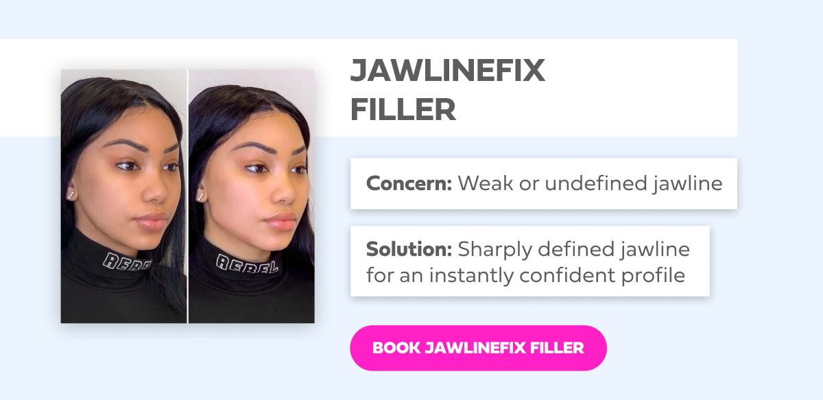 JAWLINEFIX FILLER