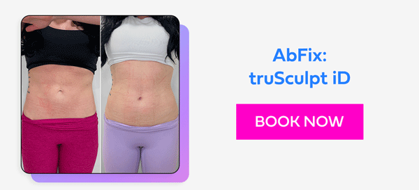 AbFix: truSculpt iD