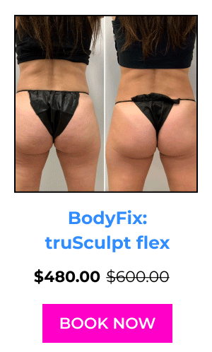 BodyFix: truSculpt flex