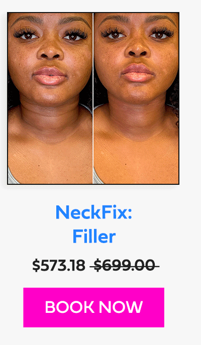 NeckFix: Filler