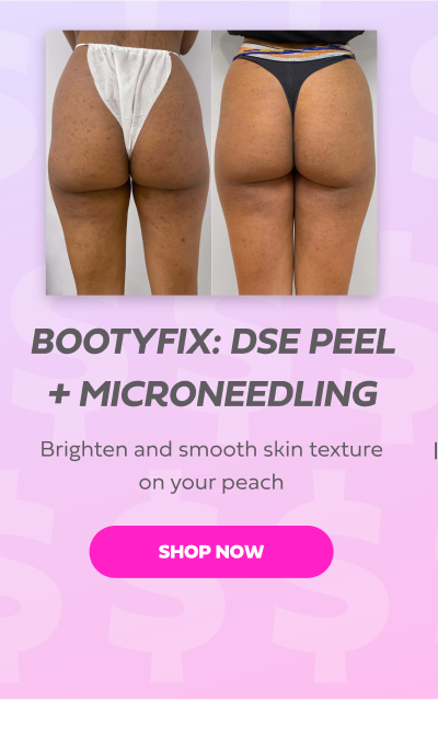 BOOTYFIX DSE PEEL + MICRONEEDLING