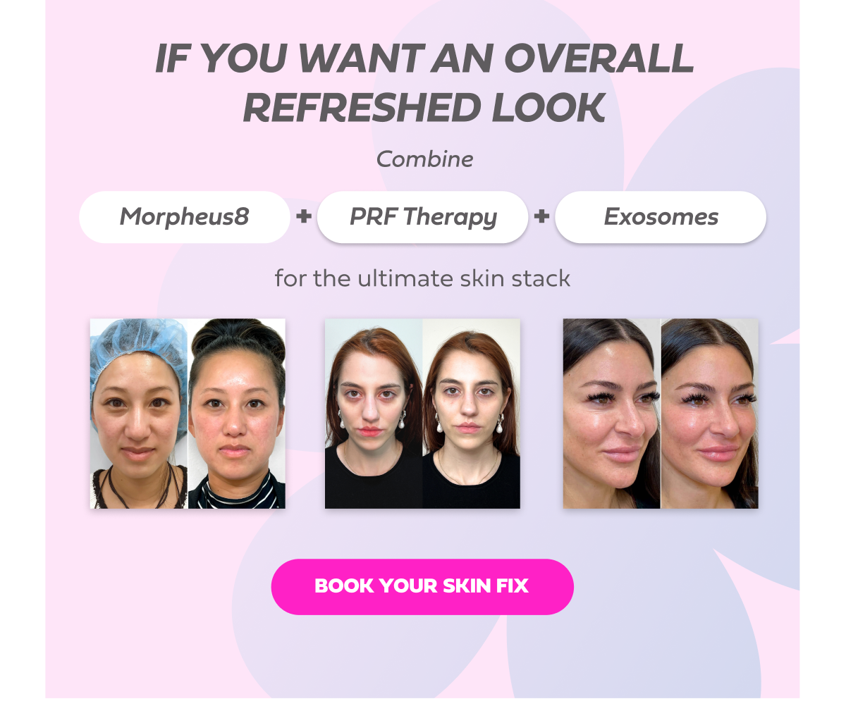 IF YOU WANT AN OVERALL REFRESHED LOOK