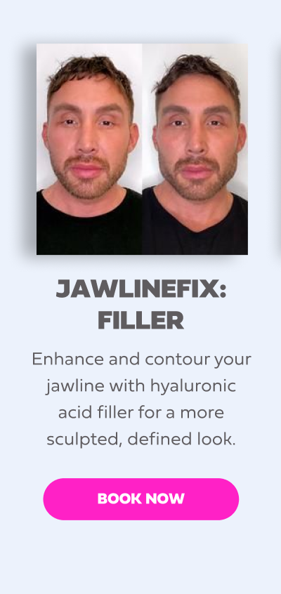 JAWLINEFIX FILLER