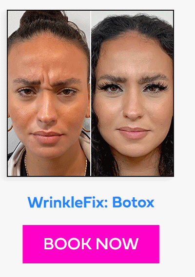 WrinkleFix: Botox
