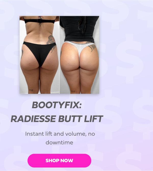 BOOTYFIX RADIESSE BUTT LIFT